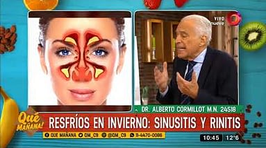 Remedios Naturales y Efectivos para la Sinusitis 2 Cómo tratar la sinusitis y rinitis